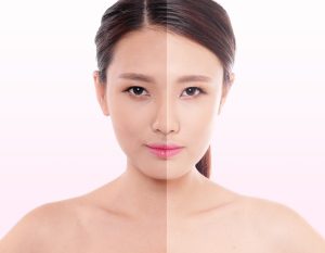 chăm sóc da uy tín tại Kiên Giang, chăm sóc da tại Rạch Giá, dưỡng da, điều trị da uy tín tại Kiên Giang