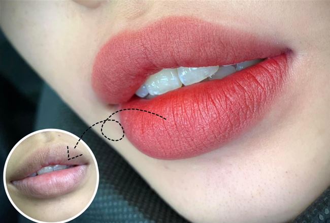 Hoảng loạn phun xăm môi mọc mụn nước