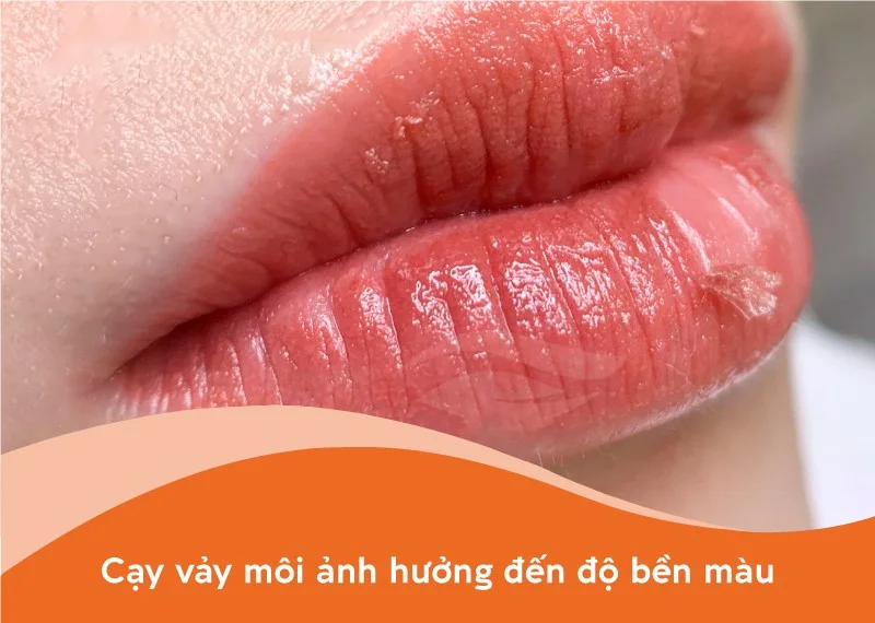 Xăm môi Những điều cần kiêng kỵ để mau lành và đẹp