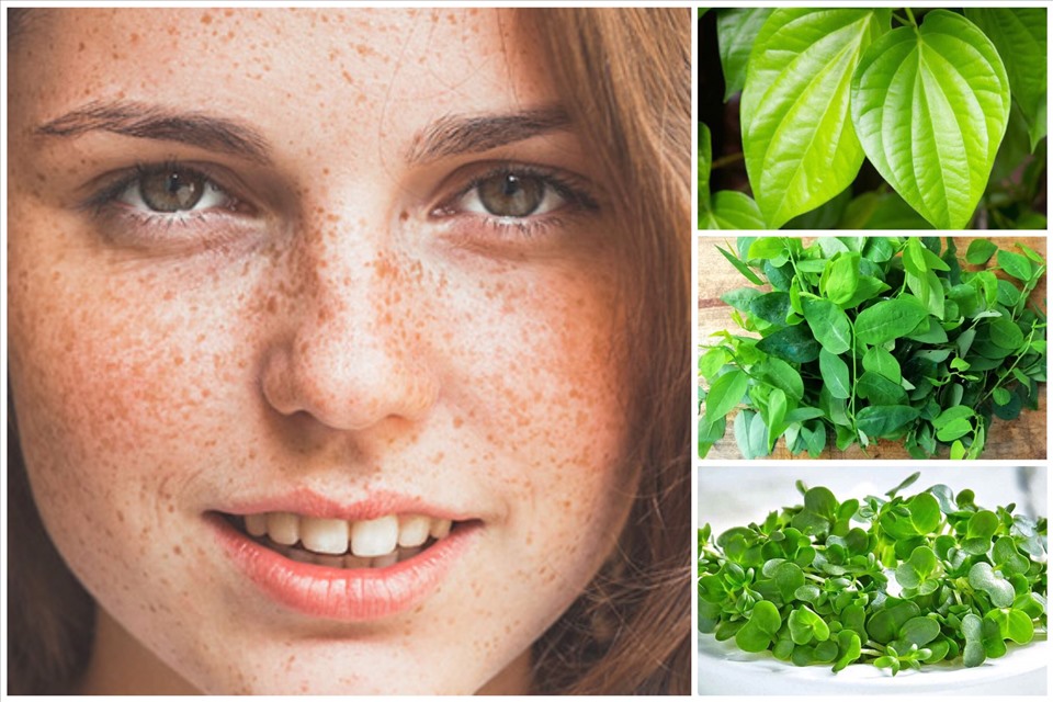 Bí Quyết Trị Nám Tự Nhiên Tại Nhà Hiệu Quả Và An Toàn