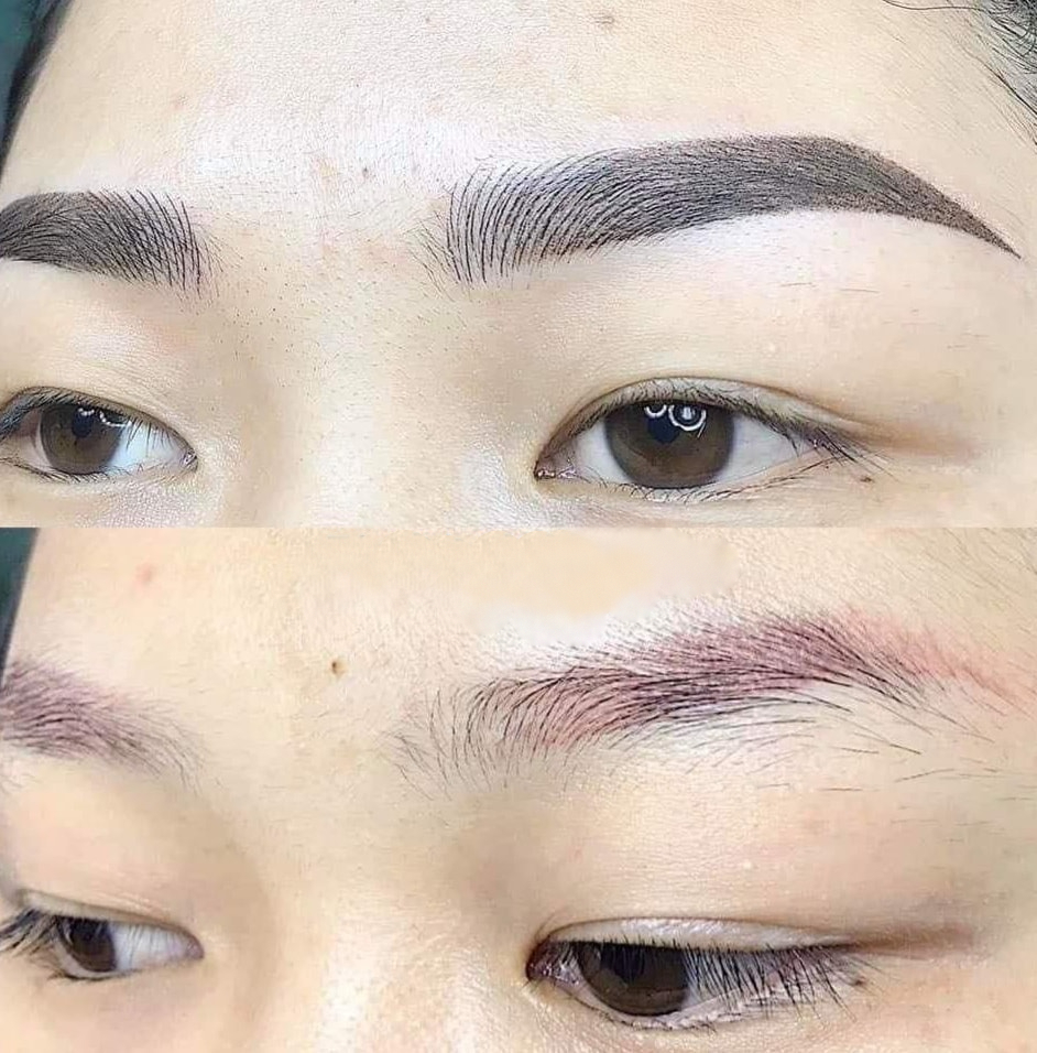 Khủng hoảng khi phải chỉnh sửa nhiều lần sau khi phun xăm chân mày phun môi