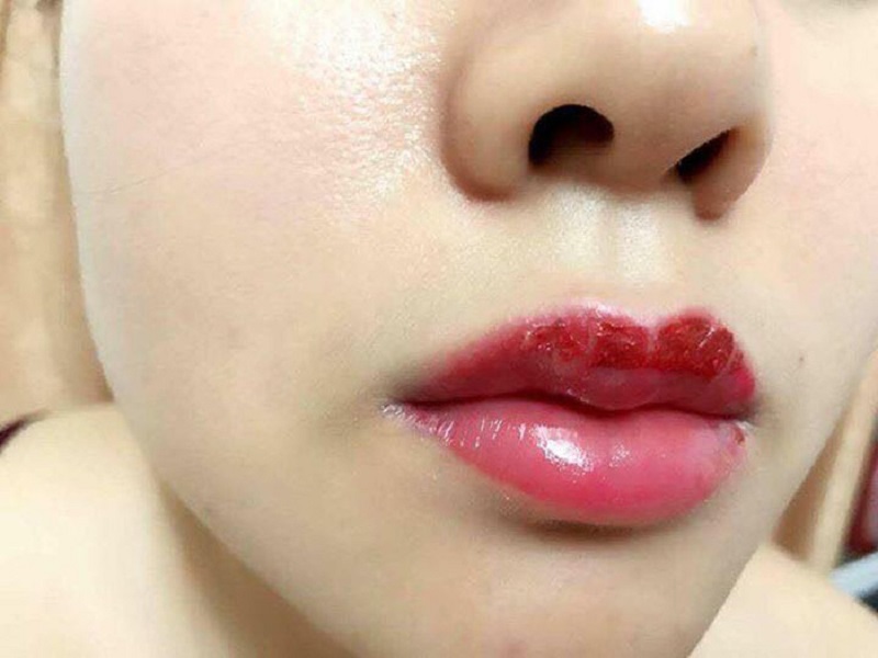 Khủng hoảng khi phải chỉnh sửa nhiều lần sau khi phun xăm chân mày phun môi